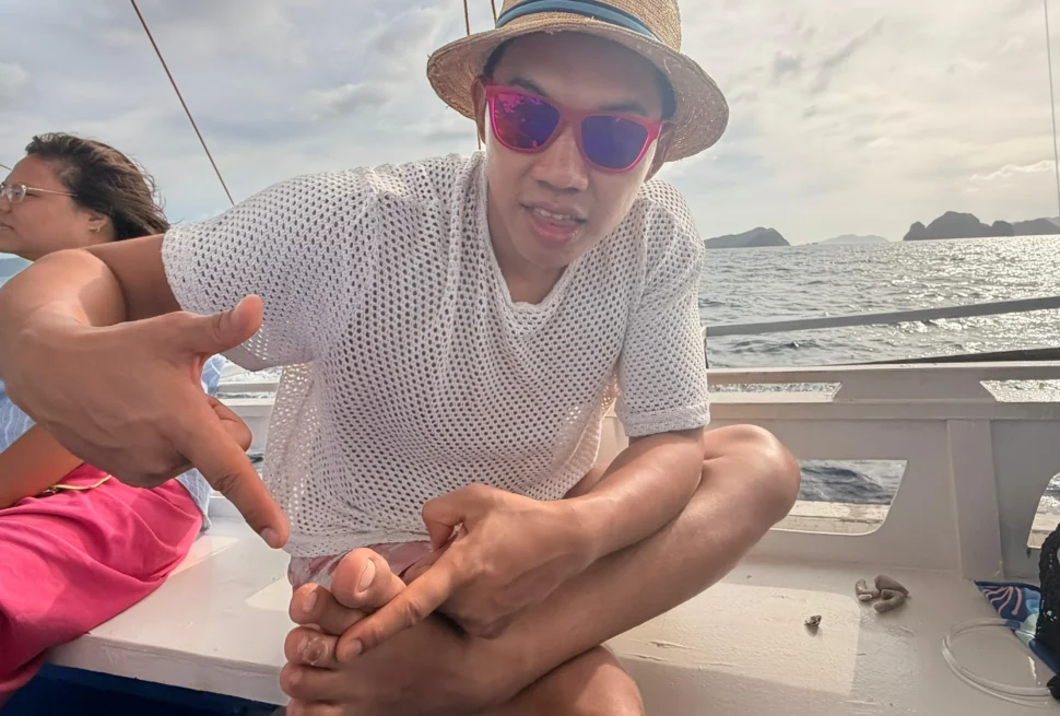 Me showing my cracked toe (1) - Liquid Bandage for Travel: Fix Cuts & Cracked Skin Fast 🩹